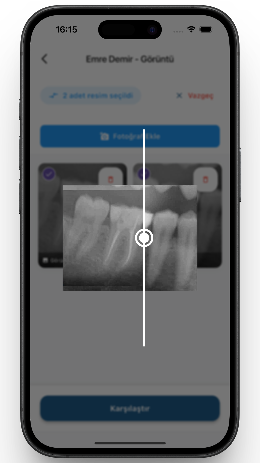 Röntgen Analizi Ekranı